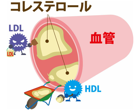 脂質異常症の診断基準（空腹時採血）